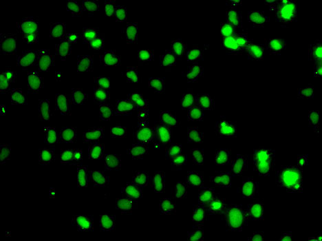 HMG20A Rabbit polyclonal antibody