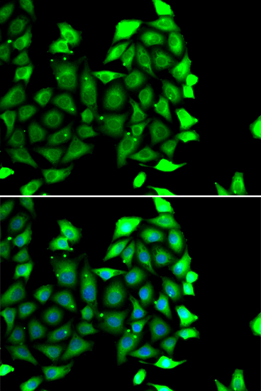 IKZF3 Rabbit polyclonal antibody