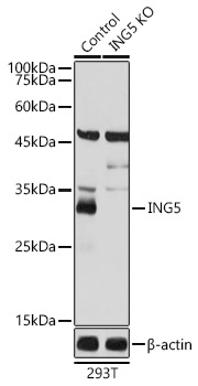 [KO Validated] ING5 Rabbit polyclonal antibody