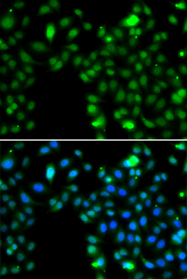 [KO Validated] ING5 Rabbit polyclonal antibody