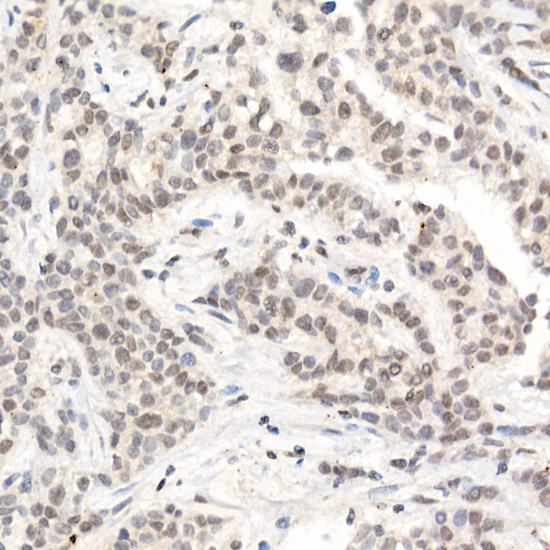L3MBTL3 Rabbit polyclonal antibody