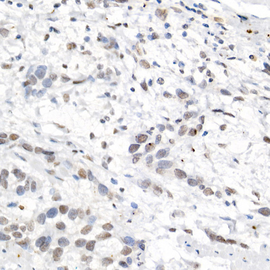L3MBTL3 Rabbit polyclonal antibody