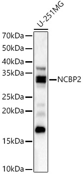 NCBP2 Rabbit polyclonal antibody