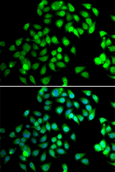 NCBP2 Rabbit polyclonal antibody