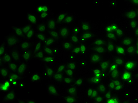 NGFRAP1 Rabbit polyclonal antibody