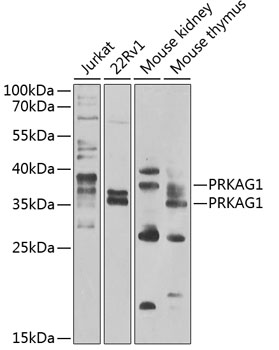 PRKAG1 Rabbit polyclonal antibody