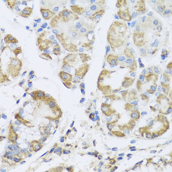 PRKAG1 Rabbit polyclonal antibody