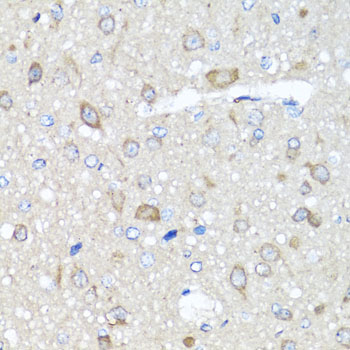 PRKAG1 Rabbit polyclonal antibody