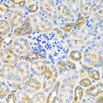 PRKAG1 Rabbit polyclonal antibody