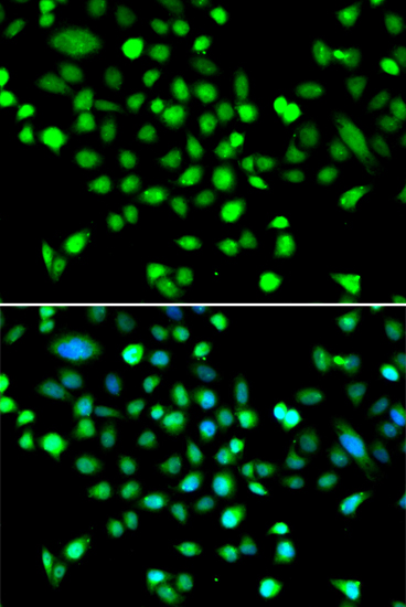 PRKAG1 Rabbit polyclonal antibody