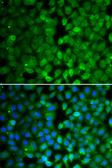 RUNX3 Rabbit polyclonal antibody