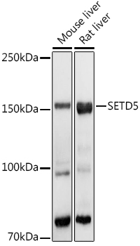 SETD5 Rabbit polyclonal antibody