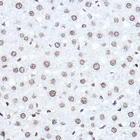 SETD5 Rabbit polyclonal antibody