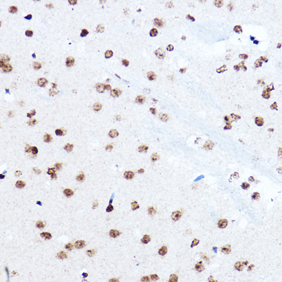 SETD5 Rabbit polyclonal antibody