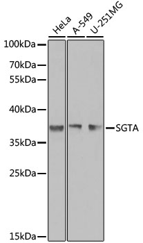 SGTA Rabbit polyclonal antibody