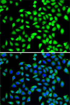 SGTA Rabbit polyclonal antibody