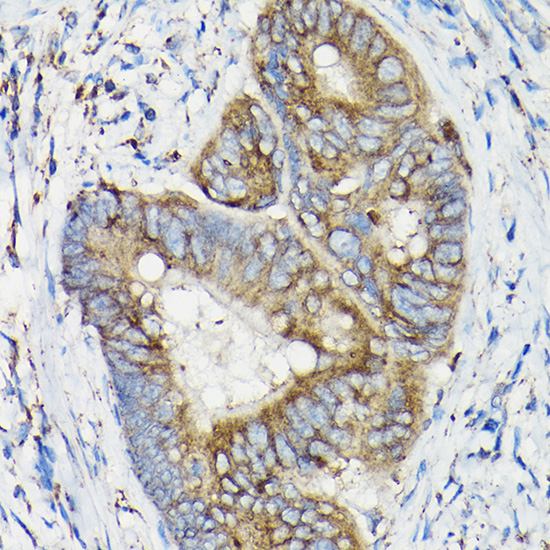 SIRT3 Rabbit polyclonal antibody