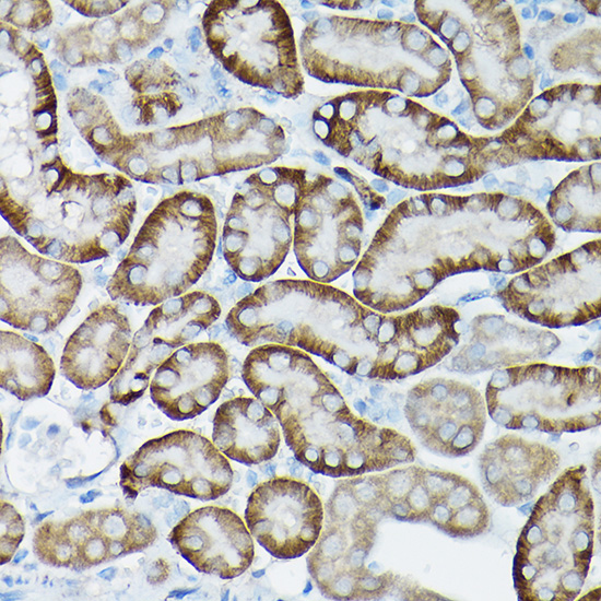 SIRT3 Rabbit polyclonal antibody