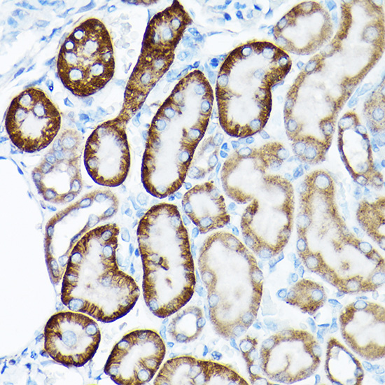 SIRT3 Rabbit polyclonal antibody