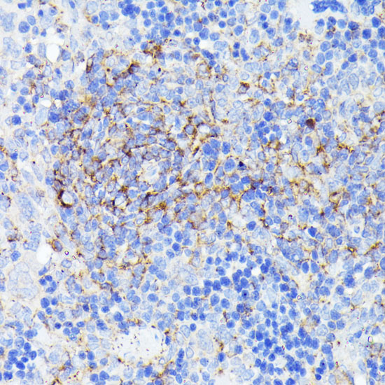 SMYD4 Rabbit polyclonal antibody
