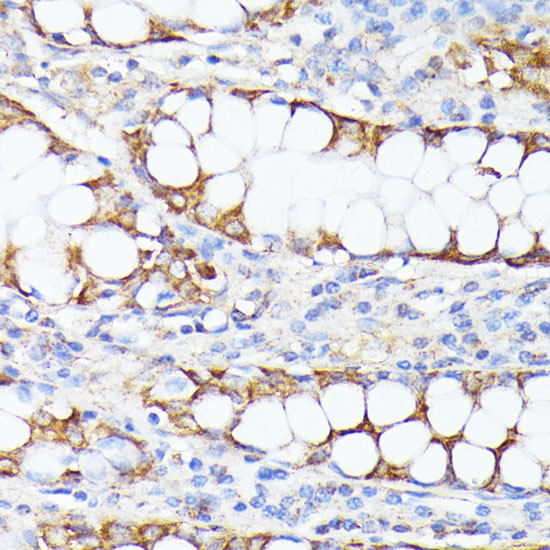SMYD4 Rabbit polyclonal antibody