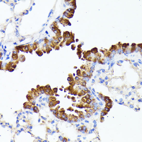 SMYD4 Rabbit polyclonal antibody