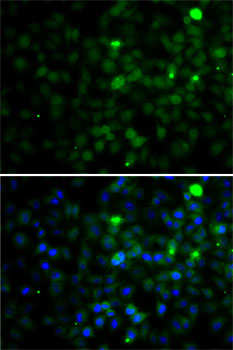 SMYD4 Rabbit polyclonal antibody