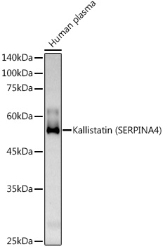 Kallistatin (SERPINA4) Rabbit polyclonal antibody