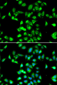 Kallistatin (SERPINA4) Rabbit polyclonal antibody