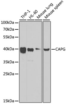 [KO Validated] CAPG Rabbit polyclonal antibody