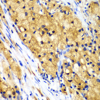 [KO Validated] CAPG Rabbit polyclonal antibody