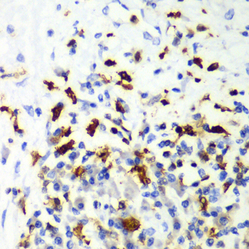 [KO Validated] CAPG Rabbit polyclonal antibody