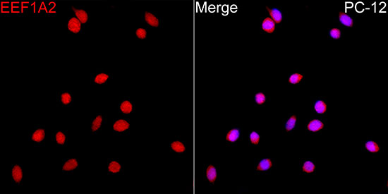 EEF1A2 Rabbit polyclonal antibody