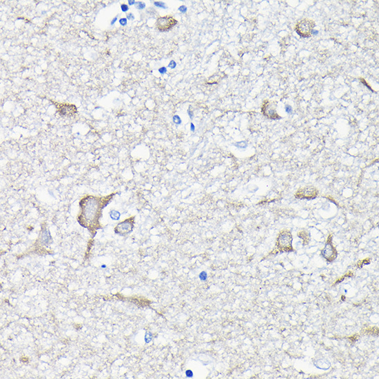 EEF1A2 Rabbit polyclonal antibody