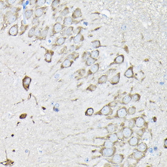 EEF1A2 Rabbit polyclonal antibody