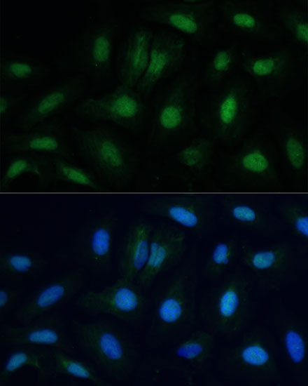 ETS2 Rabbit polyclonal antibody