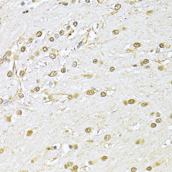 Ku70 Rabbit polyclonal antibody