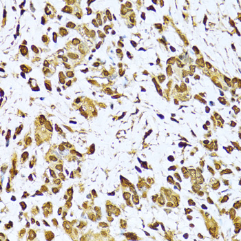 Ku70 Rabbit polyclonal antibody