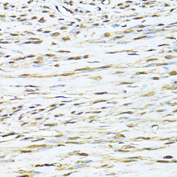 Ku70 Rabbit polyclonal antibody