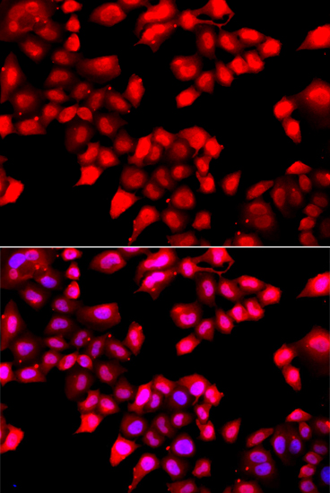 Ku70 Rabbit polyclonal antibody