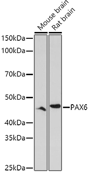 PAX6 Rabbit polyclonal antibody