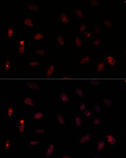 PAX6 Rabbit polyclonal antibody