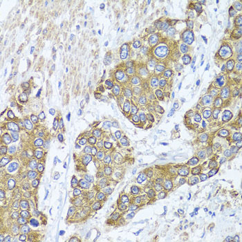 PEX14 Rabbit polyclonal antibody