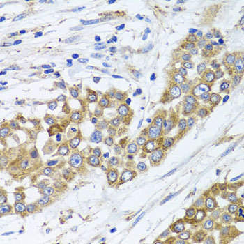 PEX14 Rabbit polyclonal antibody