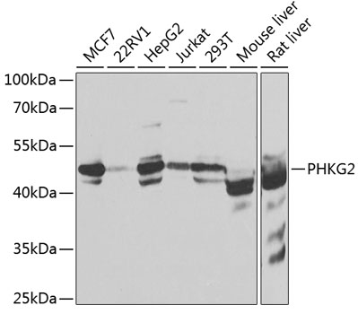 PHKG2 Rabbit polyclonal antibody