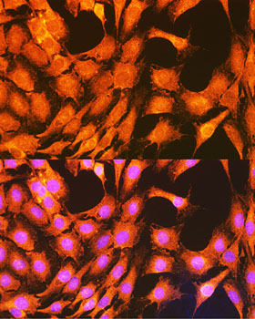 PHKG2 Rabbit polyclonal antibody