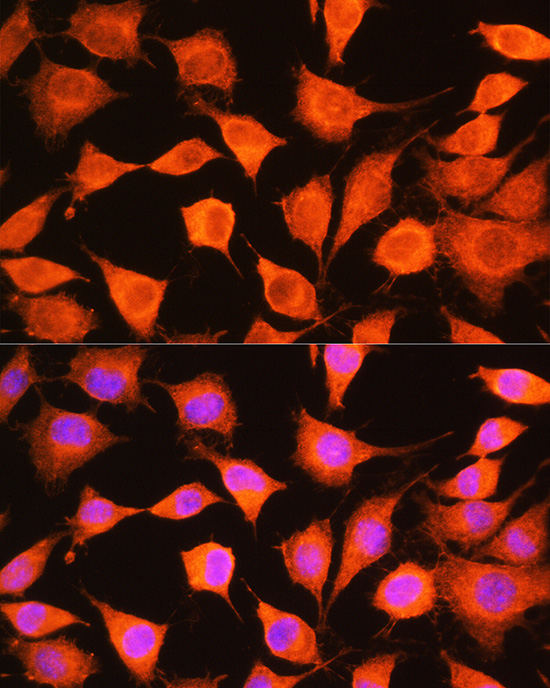 PHKG2 Rabbit polyclonal antibody