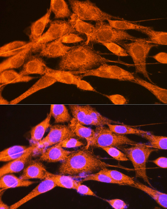 PHKG2 Rabbit polyclonal antibody