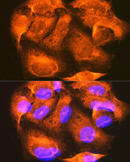 PHKG2 Rabbit polyclonal antibody