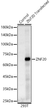 ZNF20 Rabbit polyclonal antibody